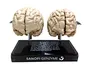 Human brain model for patient education